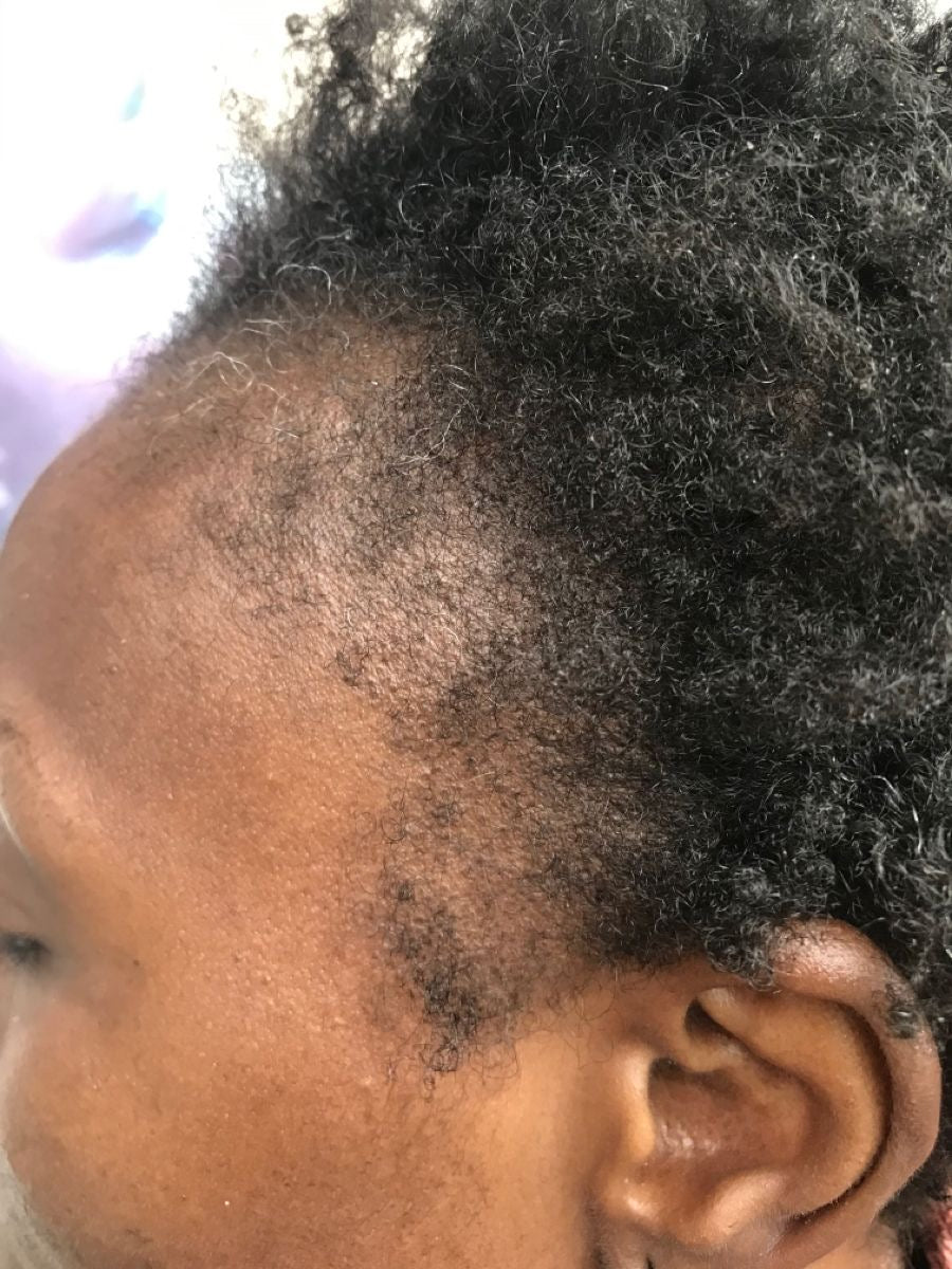 Pommade capilaire Au Tchebe et à l’huile de tchebe (Résultat Dès 7 jours)