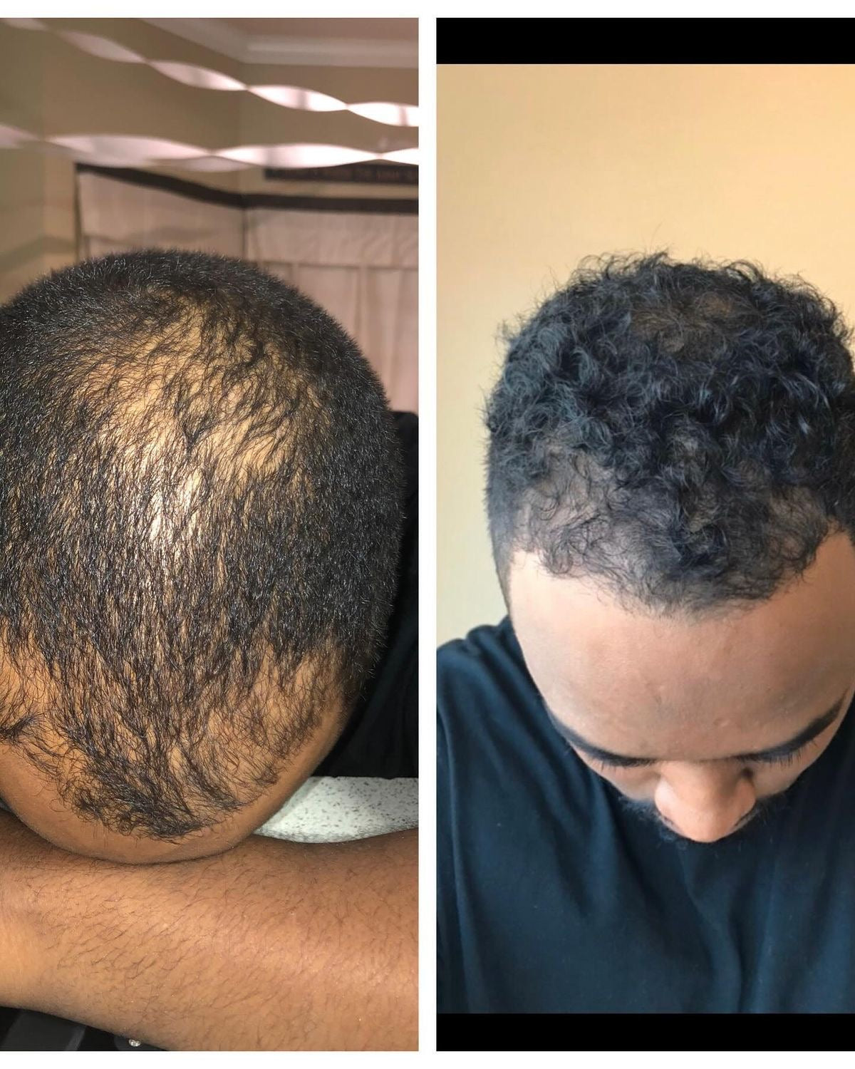 Pommade capilaire Au Tchebe et à l’huile de tchebe (Résultat Dès 7 jours)