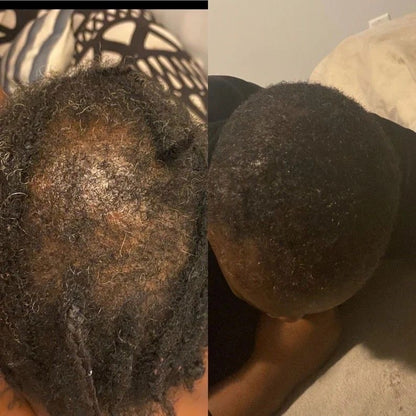 Pommade capilaire Au Tchebe et à l’huile de tchebe (Résultat Dès 7 jours)